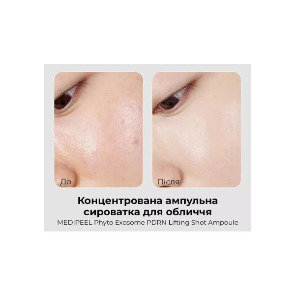 Сироватка для обличчя Medi-Peel Phyto Exosome PDRN Lifting Shot Serum 100 мл (8809941824681)