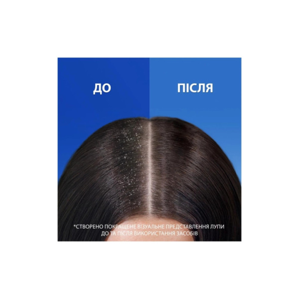 Шампунь Head & Shoulders Проти лупи Цитрусова свіжість 800 мл (8700216156172)