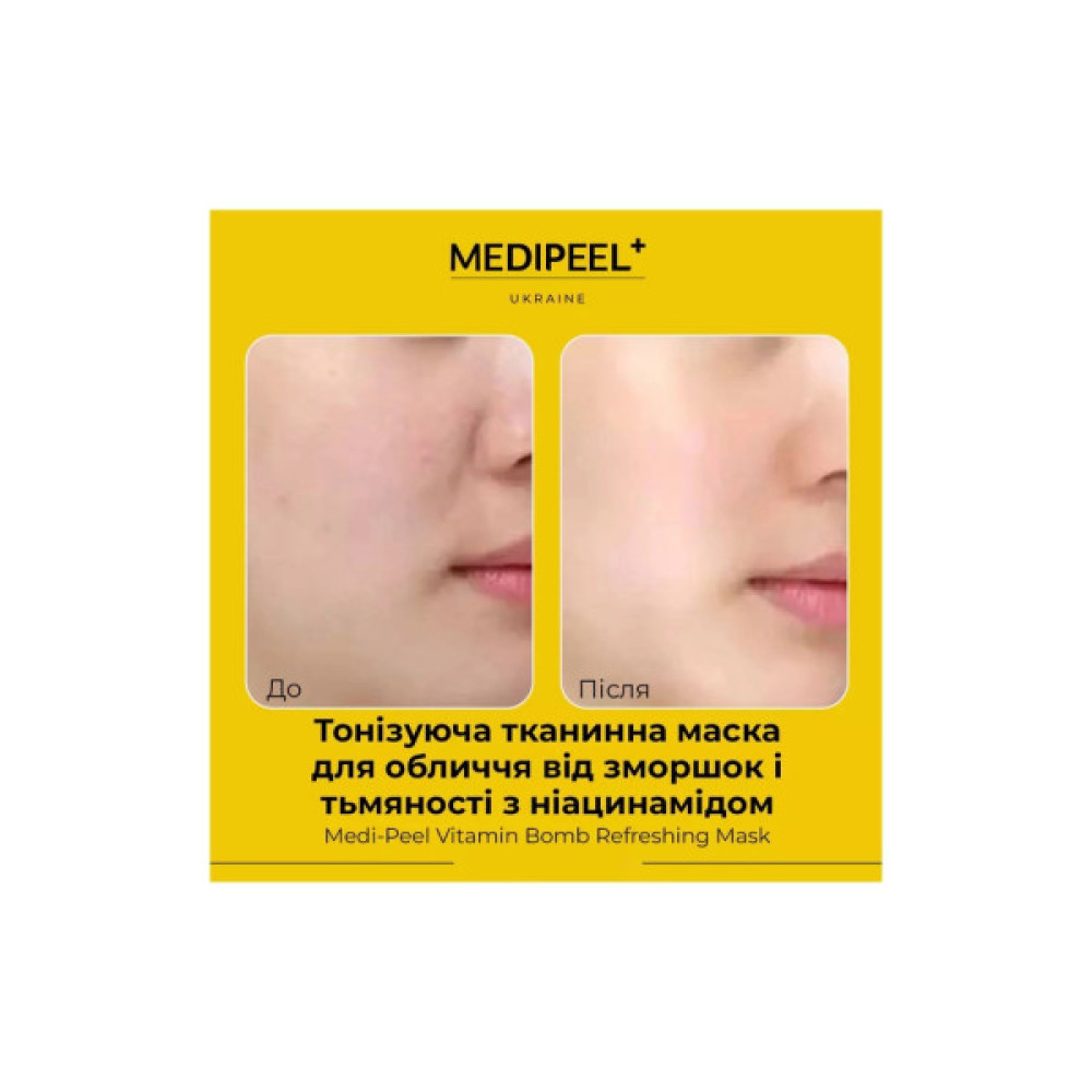 Маска для обличчя Medi-Peel Vitamin Bomb Refreshing Mask Тканинна 1 шт 25 мл (8809409345390)