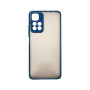 Чохол до мобільного телефона Dengos Kit for Xiaomi Redmi Note 11 Pro case + glass (Blue) (DG-KM-31) Чохол до мобільного телефона Dengos Kit for Xiaomi Redmi Note 11 Pro case + glass (Blue) (DG-KM-31)