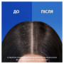 Шампунь Head & Shoulders Свіжість ментолу Проти лупи 400 мл (5011321336094) Шампунь Head & Shoulders Свіжість ментолу Проти лупи 400 мл (5011321336094)