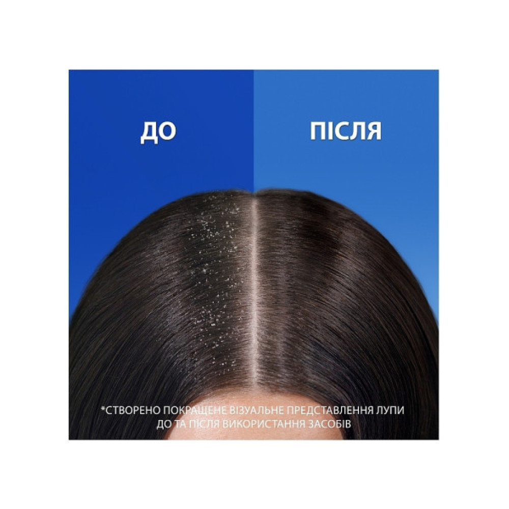 Шампунь Head & Shoulders 2 в 1 Проти лупи Гладеньке та шовковисте 330 мл (8700216304856)