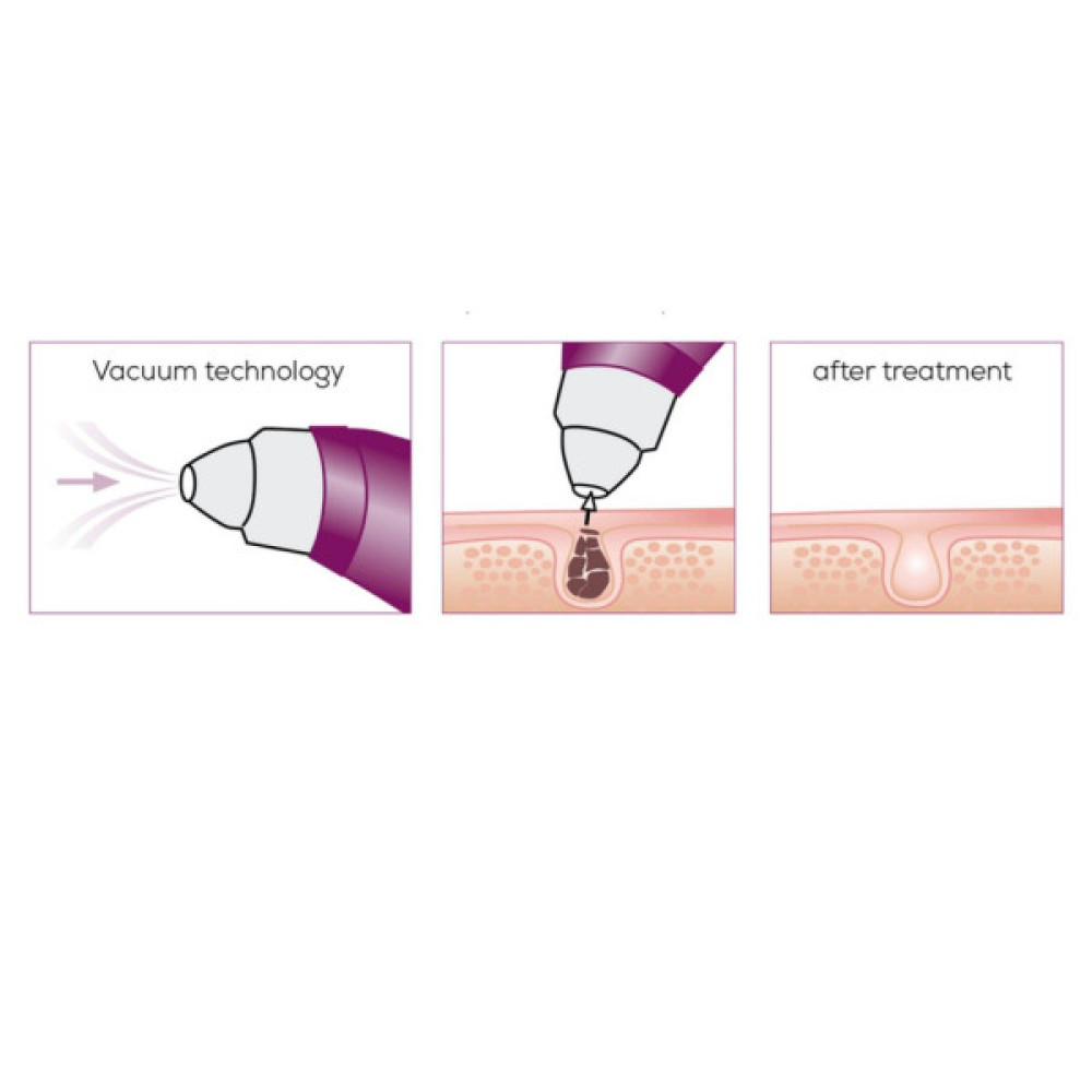 Масажер Beurer FC 41 (FC_41)