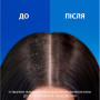 Шампунь Head & Shoulders Pro-Expert 7 Інтенсивний порятунок 250 мл (8700216156844) Шампунь Head & Shoulders Pro-Expert 7 Інтенсивний порятунок 250 мл (8700216156844)