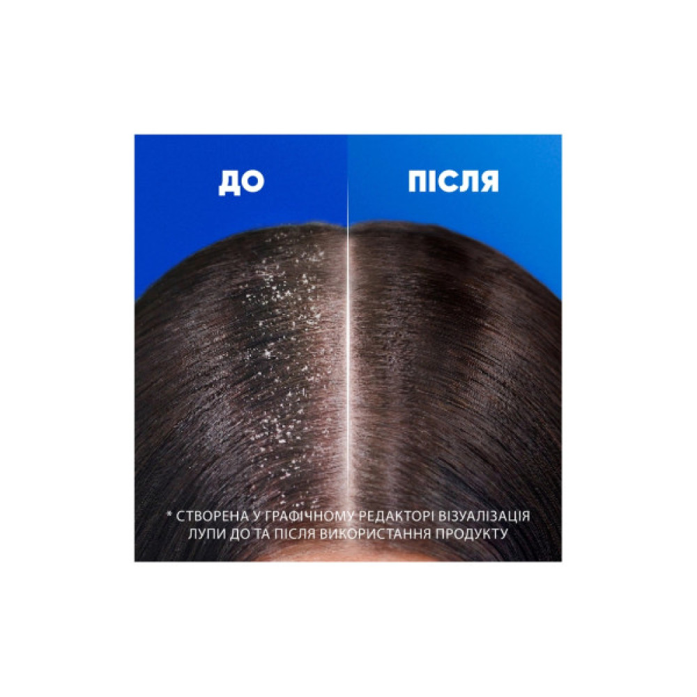 Шампунь Head & Shoulders Цитрусова свіжість 400 мл (5011321336032)