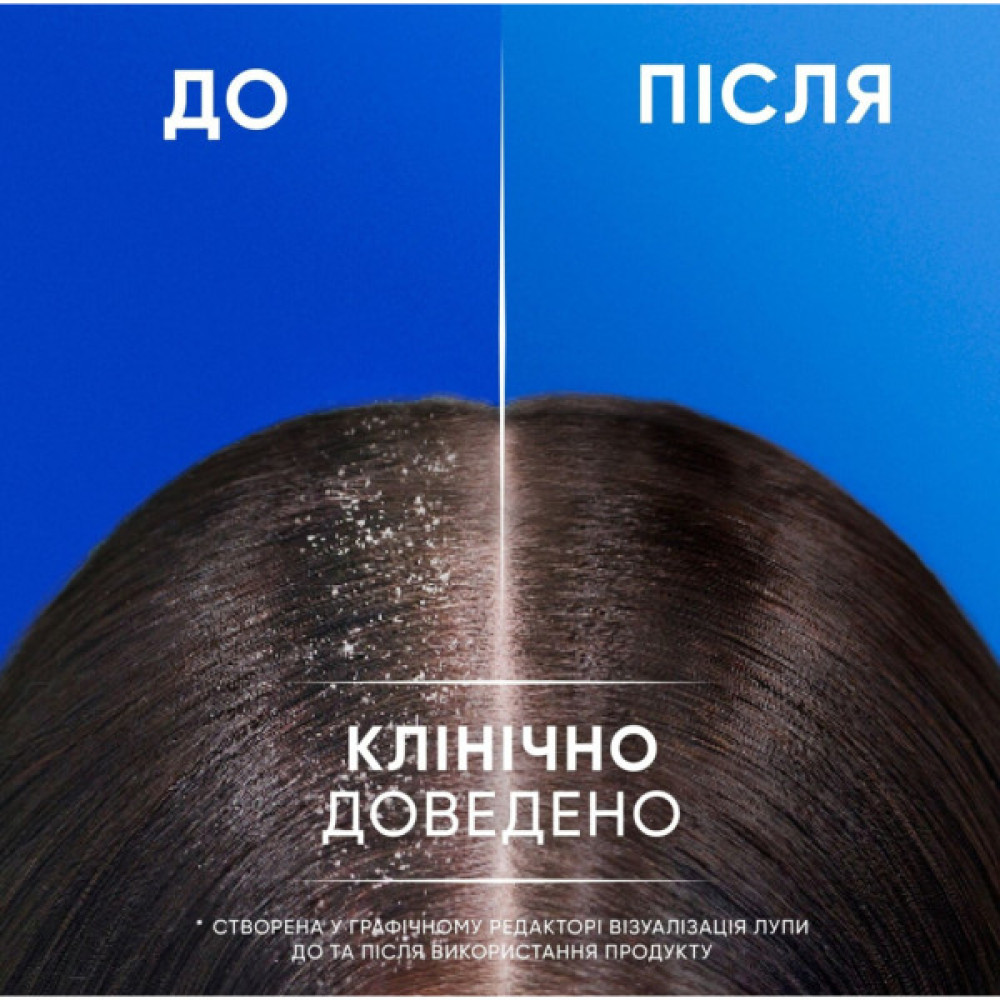 Шампунь Head & Shoulders 2 в 1 Проти лупи Яблучна свіжість 330 мл (8700216304689)