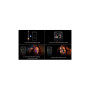 Стайлер Dyson Airwrap I.D. HS08 T3/T4 Curly+Coily Red Velvet/Gold (596928-01)