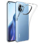 Чохол до мобільного телефона BeCover Xiaomi Mi 11 Lite Transparancy (706075) Чохол до мобільного телефона BeCover Xiaomi Mi 11 Lite Transparancy (706075)