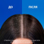 Шампунь Head & Shoulders Pro-Expert 7 Захист від випадіння волосся З кофеїном 250 мл (8700216156936) Шампунь Head & Shoulders Pro-Expert 7 Захист від випадіння волосся З кофеїном 250 мл (8700216156936)